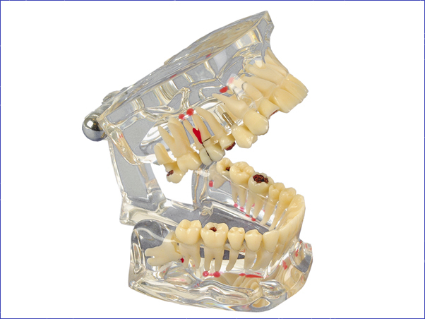 Study Model Transparent De Luxe