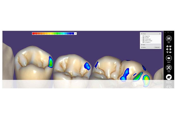 Sistema DENTAL CAD